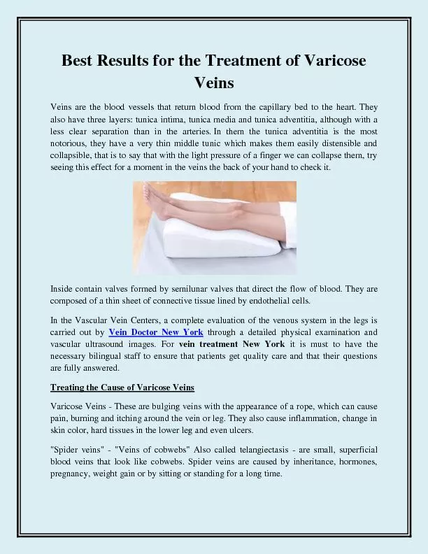 Best Results for the Treatment of Varicose Veins