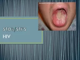 STD’s/STI’S HIV Most STD/I’S