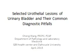 Selected  Urothelial  Lesions of Urinary Bladder and Their Common Diagnostic Pitfalls