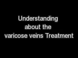 Understanding about the varicose veins Treatment