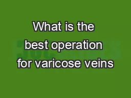 What is the best operation for varicose veins