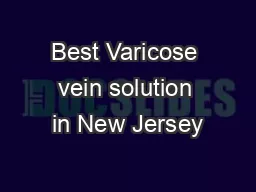 Best Varicose vein solution in New Jersey