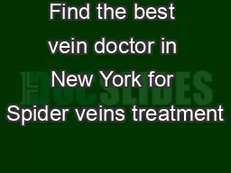 Find the best vein doctor in New York for Spider veins treatment