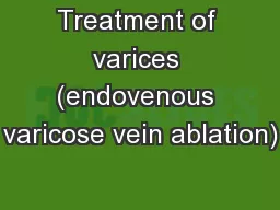 Treatment of varices (endovenous varicose vein ablation)