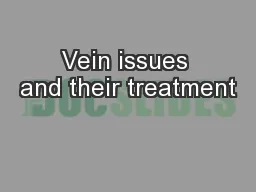 Vein issues and their treatment