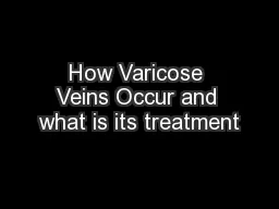 How Varicose Veins Occur and what is its treatment