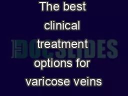 The best clinical treatment options for varicose veins