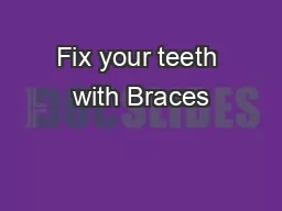 Fix your teeth with Braces