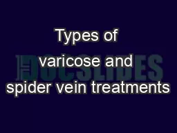 Types of varicose and spider vein treatments