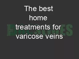 The best home treatments for varicose veins