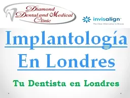 Implantología En Londres