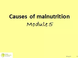 Causes of malnutrition M