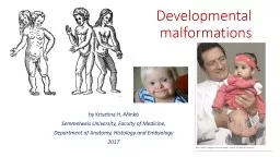 Developmental   malformations