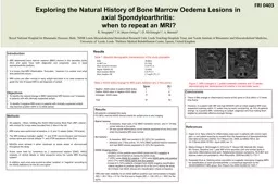 FRI 0403 Exploring  the Natural History of Bone Marrow Oedema Lesions in