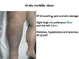Clinical case  of a  swollen limb  Emphasis  on  diagnosis Nicos Labropoulos