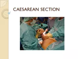 CAESAREAN SECTION SOURCE