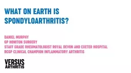 What on earth is Spondyloarthritis?