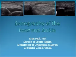 Sonography  of the Foot and Ankle