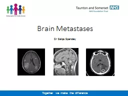 Brain Metastases Dr Saiqa Spensley