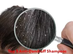 Top 5 Anti-Dandruff Shampoos