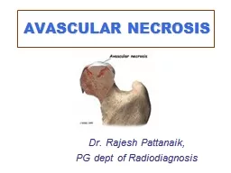  AVASCULAR NECROSIS Dr. Rajesh 