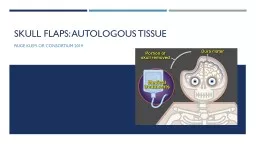 Skull flaps: autologous tissue 