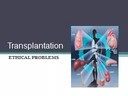  Transplantation ETHICAL PROBLEMS