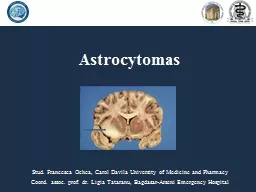  Astrocytomas Stud. Francesca 