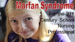  Marfan Syndrome  For the 21