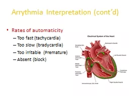  Arrythmia Interpretation (cont’d)