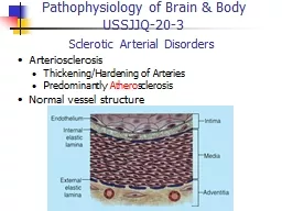  Sclerotic Arterial Disorders