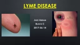  Lyme Disease  Jake Abram