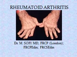  RHEUMATOID ARTHRITIS Dr. M. SOFI MD; FRCP (London); 