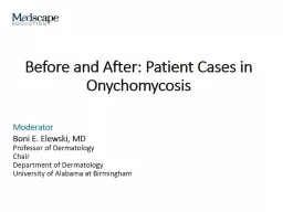 Before and After: Patient Cases in Onychomycosis