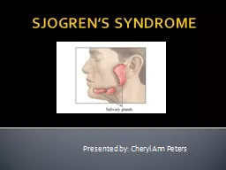 SJOGREN’S SYNDROME 		Presented by: Cheryl Ann Peters