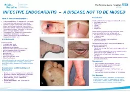 INFECTIVE ENDOCARDITIS   –