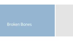 Broken Bones Open or Compound Fracture