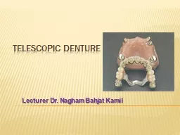 Telescopic Denture  Lecturer Dr. Nagham Bahjat Kamil