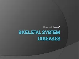 Skeletal system diseases