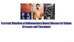 1 Current Situation of Inflammatory Bowel Disease in Taiwan