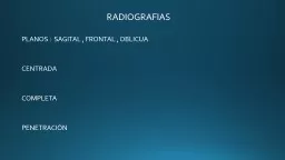 RADIOGRAFIAS PLANOS :   PERFIL