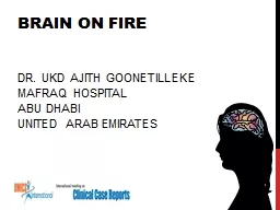 Brain on fire   Dr.  ukd