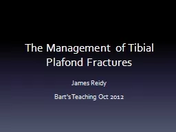 The Management of Tibial