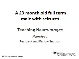 PPT-Teaching Neuro Images Neurology