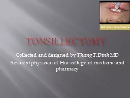 tonsillectomy Collected and designed by