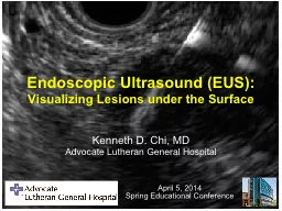 Endoscopic Ultrasound (EUS):