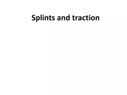 Splints and traction        Thank  You