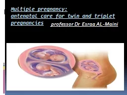 PPT-Multiple pregnancy: antenatal care for twin and triplet pregnancies