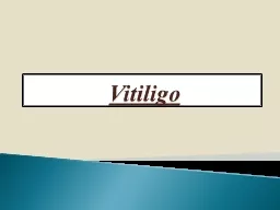 Vitiligo Definition   :
