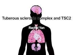 Tuberous sclerosis complex and TSC2